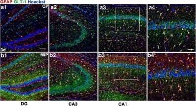 Immunohistochemistry: EAAT2/GLT1 Antibody - Azide Free [NBP1-20136] - Hippocampal GLT-1 and NR1 expression 3 days after SE with MyD88 inhibition. Sections from the hippocampi of mice in the CP group (A1-A3) and MIP group (B1-B3) 3 days after SE with GLT-1 immunoreactivity in astrocytes and neuronal processes. (A4, B4) Higher magnification of the boxes in (A3) and (B3). Scale bars: (A1-A3, B1-B3) 100 um; (A4, B4) 50 um. SE = status epilepticus, DG=dentate gyrus, hippocampal regions CA3 and CA1, CP = control peptide, MIP = MyD88 inhibitory peptide. Image collected and cropped by CiteAb from the following publication (//pubmed.ncbi.nlm.nih.gov/30112701/) licensed under a CC-BY license.